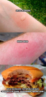Прикрепленное изображение: укус девушки.png